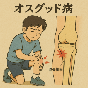 オスグッド